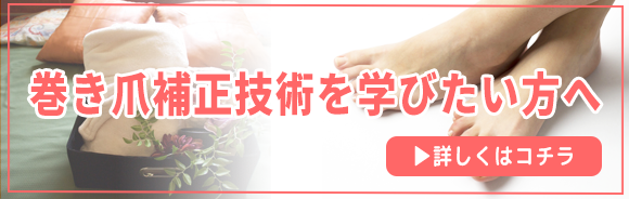 巻き爪技術学ぶ