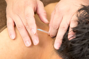 むち打ちなどの首痛の改善が得意。交通事故保険適用。